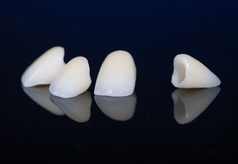 Dental Crowns