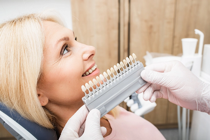 Dental Veneers on tweezers