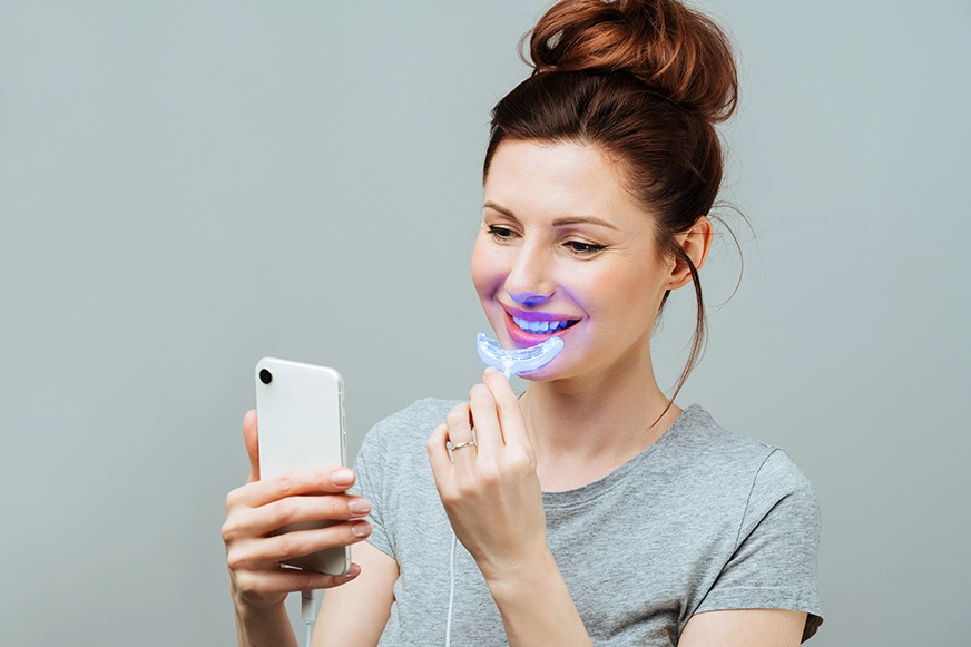 Take-home-whitening